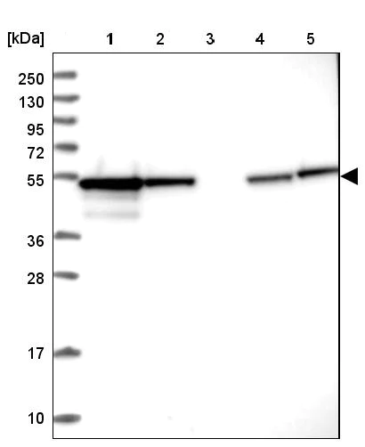 Western blot - Anti-PPP2R2B antibody (AB251885)