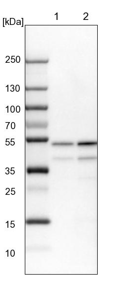 Western blot - Anti-PPP2R2B antibody (AB251885), expandable thumbnail