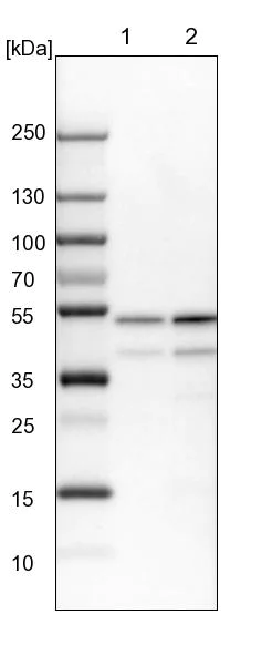 Western blot - Anti-PPP2R2B antibody (AB251885)