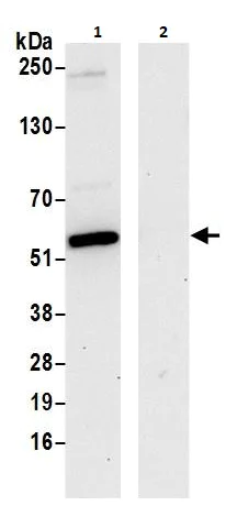 Immunoprecipitation - Anti-PPP2R2B antibody (AB264160)