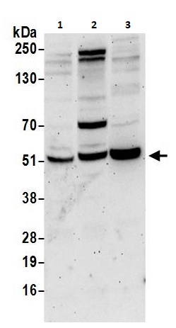 Western blot - Anti-PPP2R2B antibody (AB264160)