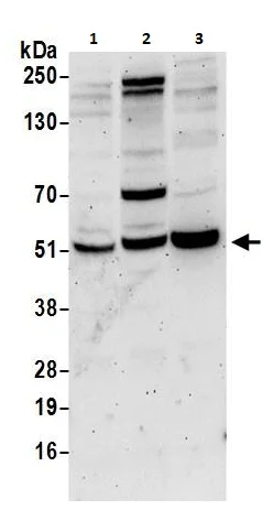 Western blot - Anti-PPP2R2B antibody (AB264160)