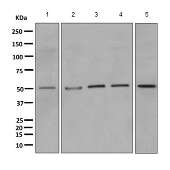 Western blot - Anti-PPP2R2B antibody [EPR10961] (AB157461)