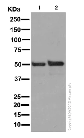 Western blot - Anti-PPP2R2B antibody [EPR10961] (AB157461)