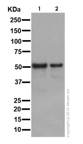 Western blot - Anti-PPP2R2B antibody [EPR10961] (AB157461)