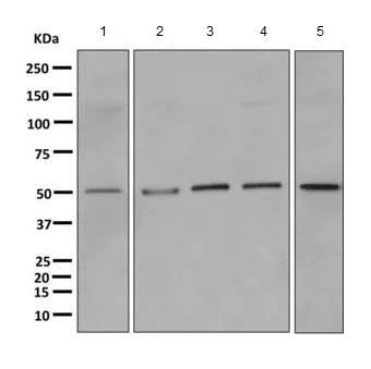 Western blot - Anti-PPP2R2B antibody [EPR10961] - BSA and Azide free (AB249330)