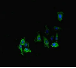 Immunocytochemistry/ Immunofluorescence - Anti-PPP2R2D antibody (AB229863)