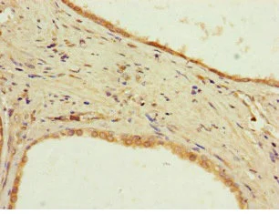 Immunohistochemistry (Formalin/PFA-fixed paraffin-embedded sections) - Anti-PPP2R2D antibody (AB229863)
