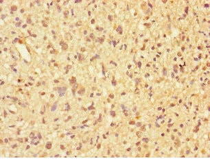 Immunohistochemistry (Formalin/PFA-fixed paraffin-embedded sections) - Anti-PPP2R2D antibody (AB229863)