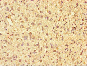 Immunohistochemistry (Formalin/PFA-fixed paraffin-embedded sections) - Anti-PPP2R2D antibody (AB229863)