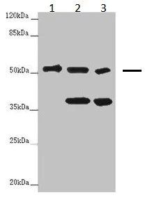 Western blot - Anti-PPP2R2D antibody (AB229863)