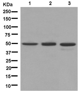 Western blot - Anti-PPP2R2D antibody [EPR13624] - BSA and Azide free (AB250325), expandable thumbnail