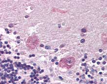 Immunohistochemistry (Formalin/PFA-fixed paraffin-embedded sections) - Anti-PPP2R3A antibody (AB115760)