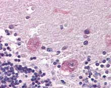 Immunohistochemistry (Formalin/PFA-fixed paraffin-embedded sections) - Anti-PPP2R3A antibody (AB115760)