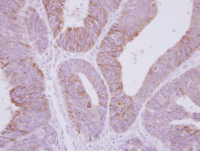 Immunohistochemistry (Formalin/PFA-fixed paraffin-embedded sections) - Anti-PPP2R3A antibody (AB126195), expandable thumbnail