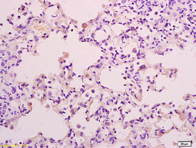 Immunohistochemistry (Formalin/PFA-fixed paraffin-embedded sections) - Anti-PPP2R3A antibody (AB218165)