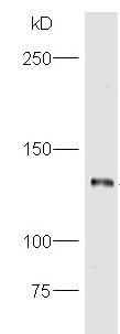 Western blot - Anti-PPP2R3A antibody (AB218165)