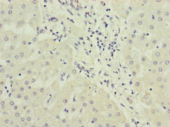 Immunohistochemistry (Formalin/PFA-fixed paraffin-embedded sections) - Anti-PPP2R3B antibody (AB234731)