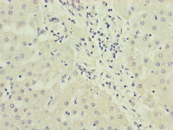 Immunohistochemistry (Formalin/PFA-fixed paraffin-embedded sections) - Anti-PPP2R3B antibody (AB234731)