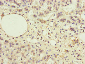 Immunohistochemistry (Formalin/PFA-fixed paraffin-embedded sections) - Anti-PPP2R3B antibody (AB234731)