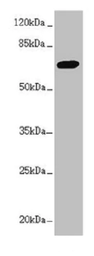 Western blot - Anti-PPP2R3B antibody (AB234731)
