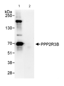 Immunoprecipitation - Anti-PPP2R3B antibody (AB72027)