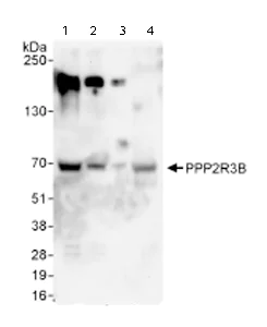 Western blot - Anti-PPP2R3B antibody (AB72027)