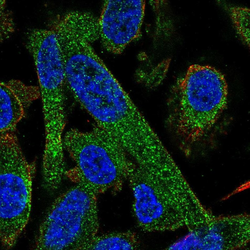 Immunocytochemistry/ Immunofluorescence - Anti-PPP2R5A antibody (AB247135), expandable thumbnail