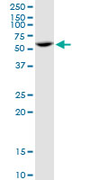 Western blot - Anti-PPP2R5A antibody (AB89621), expandable thumbnail
