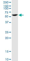 Western blot - Anti-PPP2R5A antibody (AB89621)