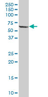 Western blot - Anti-PPP2R5A antibody (AB89621), expandable thumbnail