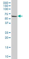 Western blot - Anti-PPP2R5A antibody (AB89621)