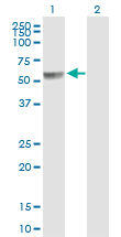 Western blot - Anti-PPP2R5A antibody (AB89621), expandable thumbnail