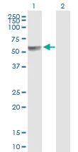Western blot - Anti-PPP2R5A antibody (AB89621)