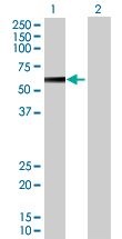 Western blot - PPP2R5A overexpression 293T lysate (whole cell) (AB94164), expandable thumbnail