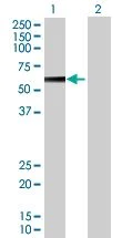Western blot - PPP2R5A overexpression 293T lysate (whole cell) (AB94164)