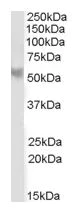 Western blot - Anti-PPP2R5B antibody (AB1366)