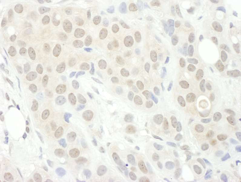Immunohistochemistry (Formalin/PFA-fixed paraffin-embedded sections) - Anti-PPP2R5C antibody (AB264338), expandable thumbnail