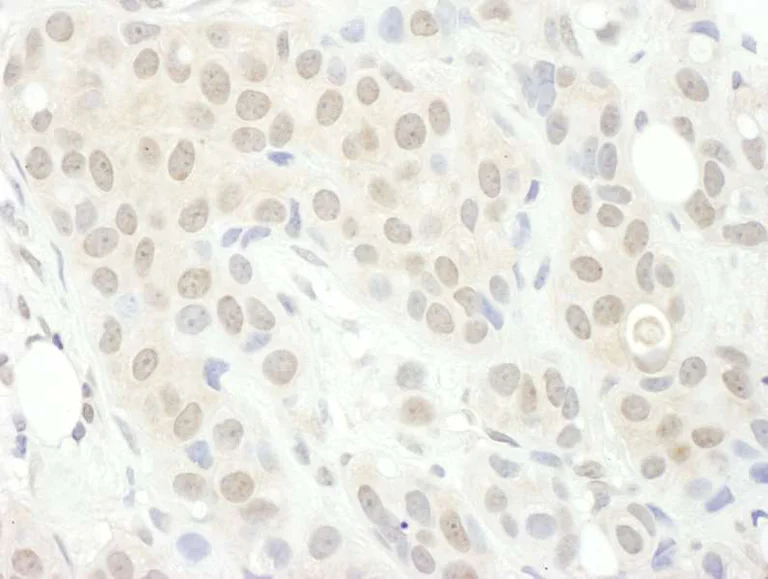 Immunohistochemistry (Formalin/PFA-fixed paraffin-embedded sections) - Anti-PPP2R5C antibody (AB264338)