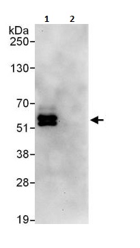 Immunoprecipitation - Anti-PPP2R5C antibody (AB264338), expandable thumbnail