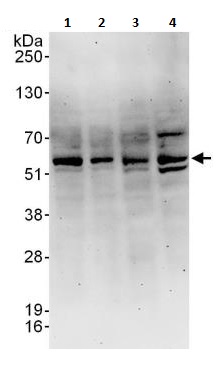 Western blot - Anti-PPP2R5C antibody (AB264338), expandable thumbnail