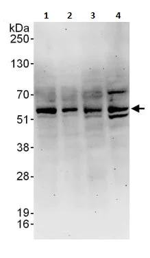 Western blot - Anti-PPP2R5C antibody (AB264338)