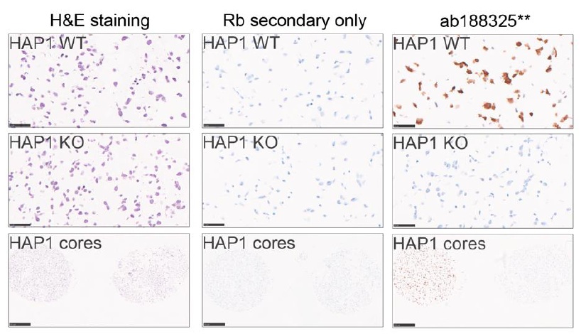 Immunohistochemistry (Formalin/PFA-fixed paraffin-embedded sections) - Anti-PPP2R5D antibody [EPR15617-50] (AB188325)