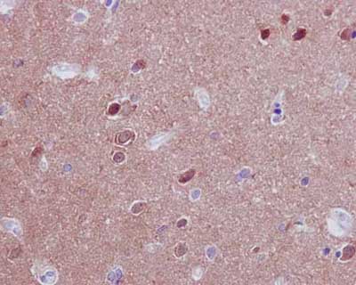 Immunohistochemistry (Formalin/PFA-fixed paraffin-embedded sections) - Anti-PPP2R5D antibody [EPR15617-50] (AB188325)