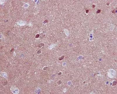 Immunohistochemistry (Formalin/PFA-fixed paraffin-embedded sections) - Anti-PPP2R5D antibody [EPR15617-50] (AB188325)