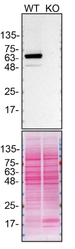 Western blot - Anti-PPP2R5D antibody [EPR15617-50] (AB188325)