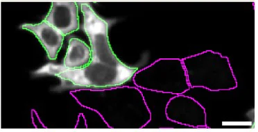 Immunocytochemistry/ Immunofluorescence - Anti-PPP2R5D antibody [EPR15617-50] - BSA and Azide free (AB250953)