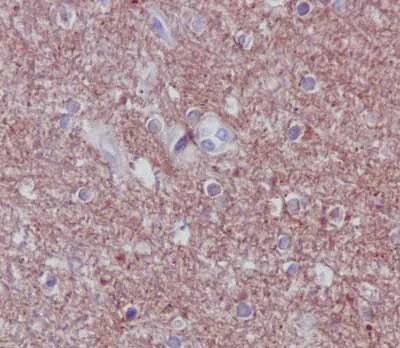 Immunohistochemistry (Formalin/PFA-fixed paraffin-embedded sections) - Anti-PPP2R5D antibody [EPR15617-50] - BSA and Azide free (AB250953)