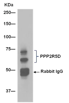 Immunoprecipitation - Anti-PPP2R5D antibody [EPR15617-50] - BSA and Azide free (AB250953)