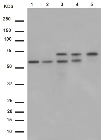 Western blot - Anti-PPP2R5D antibody [EPR15617-50] - BSA and Azide free (AB250953)